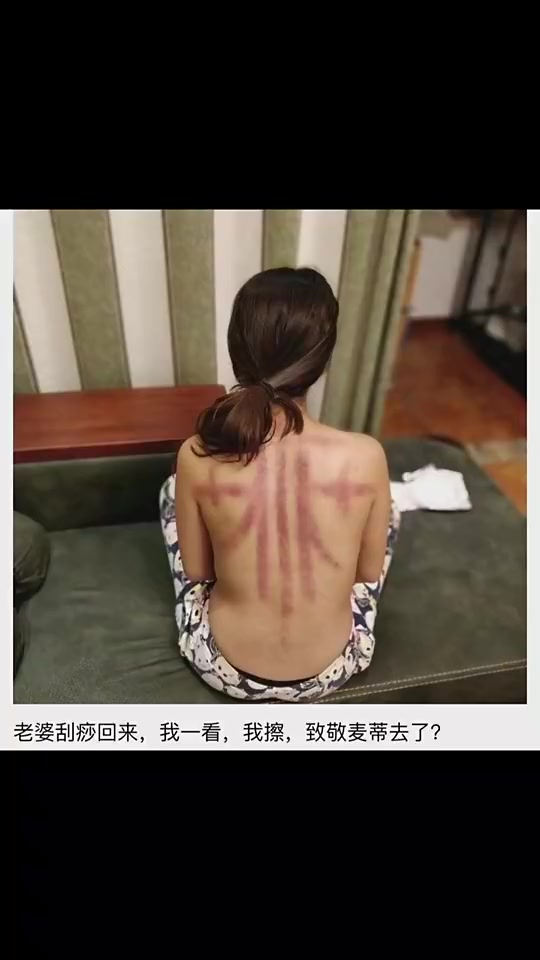 你別說,還真像!老婆這刮痧是去致敬麥迪嗎???
